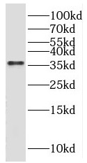 SGCG antibody|SGCG抗体