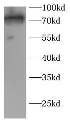 TAB2 antibody|TAB2抗体 FNab10157