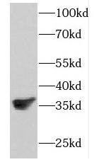 FKBP6 antibody|FKBP6抗体 FNab031