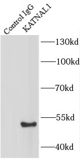 IFIH1 antibody|IFIH1抗体