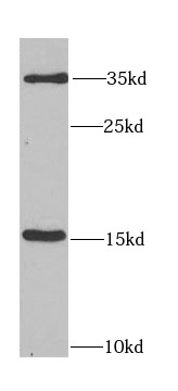 FGF1 antibody|FGF1抗体