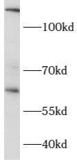 CCT6B antibody|CCT6B抗体