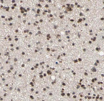 NXF3 antibody|NXF3抗体