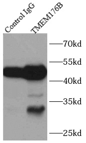 SYNJ2BP antibody|SYNJ2BP抗体