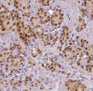 SPOP antibody|SPOP抗体