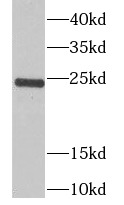 TPPP antibody|TPPP抗体 FNab08897