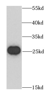 BCAS2 antibody|BCAS2抗体