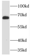 TCTN3 antibody|TCTN3抗体