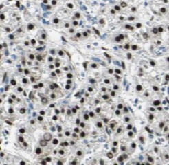 TEAD1 antibody|TEAD1抗体 FNab085