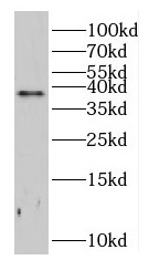 CCNH1 antibody|CCNH1抗体