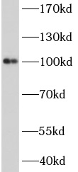 ACTN3 antibody|ACTN3抗体 FNab001