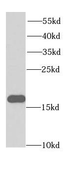 EIF5A antibody|EIF5A抗体 FNab027