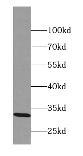 MARCHF8 antibody|MARCHF8抗体