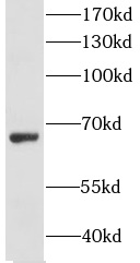 GRB7 antibody|GRB7抗体