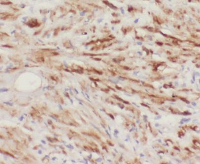 MMP26 antibody|MMP26抗体