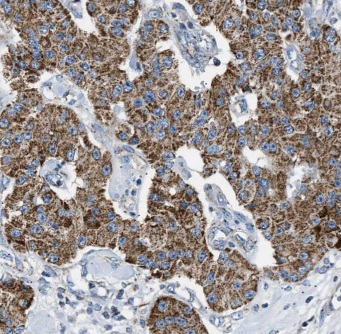 EPHX2 antibody|EPHX2抗体