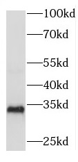 RDM1 antibody|RDM1抗体