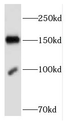 FNDC3B antibody|FNDC3B抗体