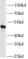S1PR5 antibody|S1PR5抗体
