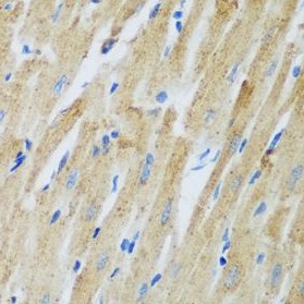 ADAM12 antibody|ADAM12抗体