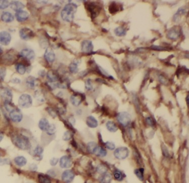 ODAM antibody|ODAM抗体