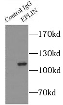 DNM3 antibody|DNM3抗体