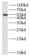 STEAP3 antibody|STEAP3抗体