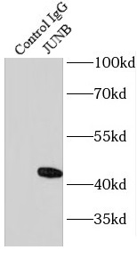 IDH1 antibody|IDH1抗体 FNab04117