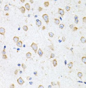 PROK2 antibody|PROK2抗体