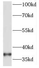HOXA11 antibody|HOXA11抗体