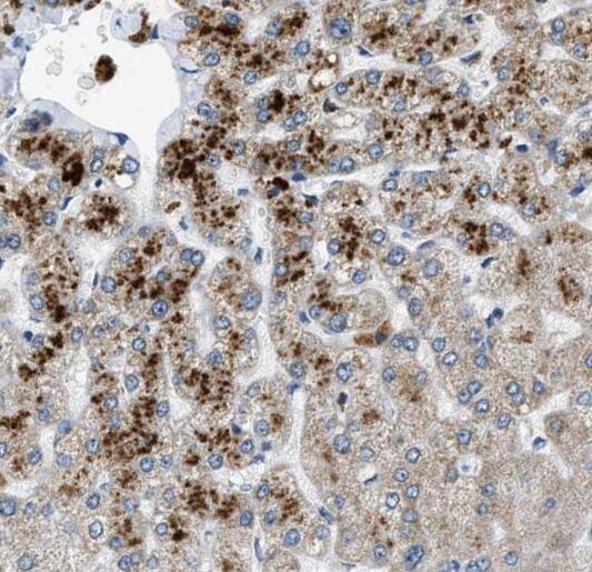 RPS25 antibody|RPS25抗体 FNab074