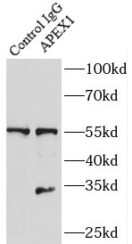 ADAMTSL4 antibody|ADAMTSL4抗体