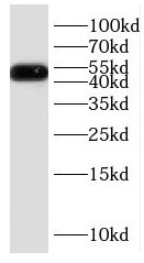 DRD1 antibody|DRD1抗体