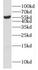 CYP4F11 antibody|CYP4F11抗体