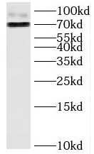 HJURP antibody|HJURP抗体