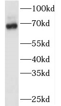 TAF6L antibody|TAF6L抗体
