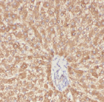 LAPTM4B antibody|LAPTM4B抗体