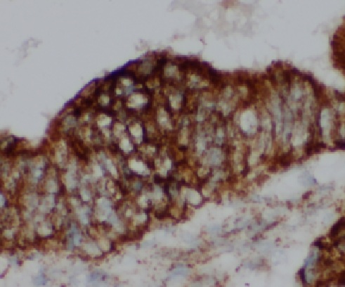 LEO1 antibody|LEO1抗体