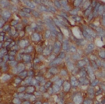 CCPG1 antibody|CCPG1抗体