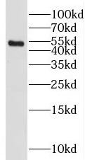 SETD7 antibody|SETD7抗体