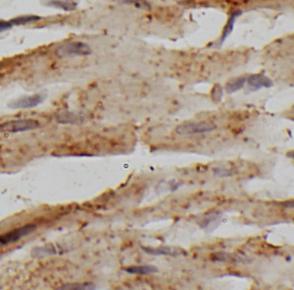 RPS6 antibody|RPS6抗体