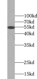 KRT8 antibody|KRT8抗体 FNab02221