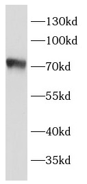 TGFBR2 antibody|TGFBR2抗体