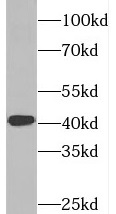 SYCE1 antibody|SYCE1抗体 FNab084
