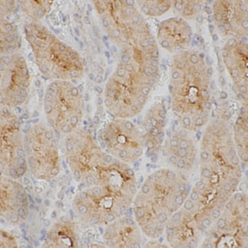 MED16 antibody|MED16抗体