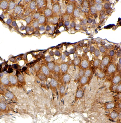 TRIM37 antibody|TRIM37抗体