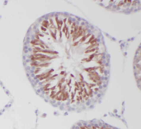 PGAP1 antibody|PGAP1抗体