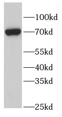 FEM1B antibody|FEM1B抗体 FNab030