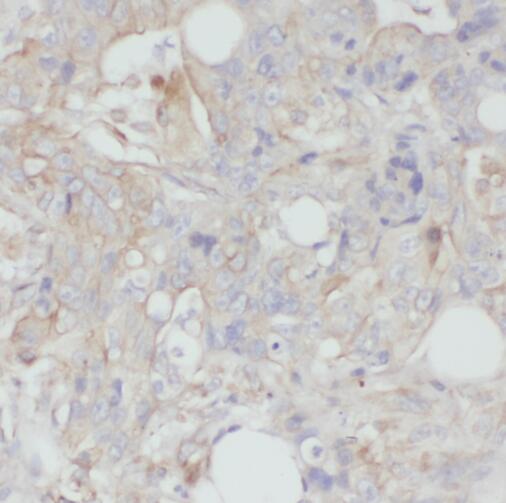 TMEM190 antibody|TMEM190抗体