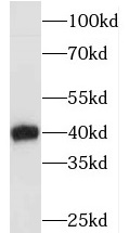 ECI2 antibody|ECI2抗体